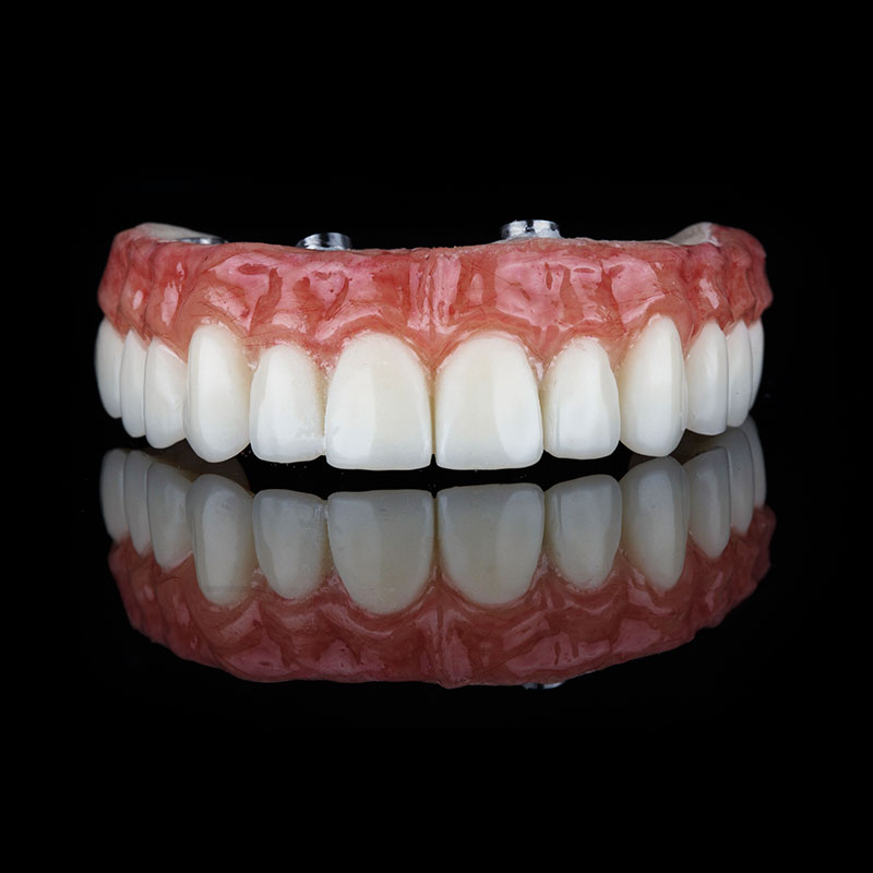 Removable Hybrid Denture Detail Dental